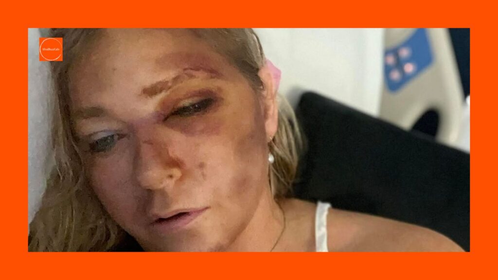 VirginiaGiuffre | BreakingNews | CarAccident | PrinceAndrew | EpsteinScandal | Mystery | TrueCrime | VirginiaGiuffreAccident | CarCrashUpdate | JeffreyEpstein | NewsUpdate | AccidentInvestigation | HighProfileCase | TrueCrimeNews | LegalNews | Scandal | PublicFigure | SocialMediaNews | 